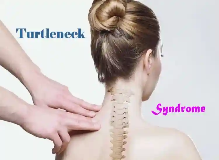 Turtle Neck Syndrome: Causes, Symptoms and Solutions